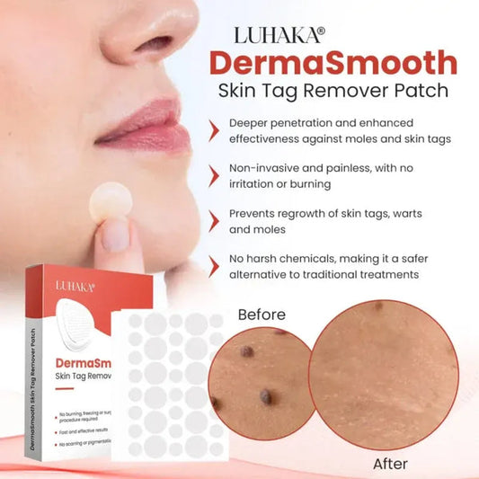 ( Buy 1 Get 1 Free ) Derma Smooth Skin Tag Removal Patch